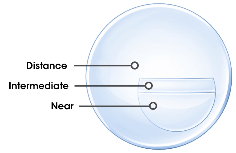 Trifocal Lenses